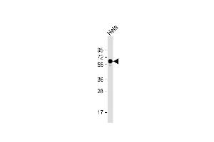 Anti-PKM2 Antibody (C-term ) at 1:1000 dilution + Hela whole cell lysate Lysates/proteins at 20 μg per lane. (PKM2 anticorps  (C-Term))