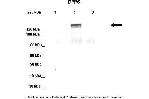 Lanes:   Lane 1: 20ug HEK-293 cell lysate Lane 2: 20ug hDPP6-YFP transfected HEK-293 lysate Lane 3: 20ug hDPP10-YFP transfected HEK-293 lysate  Primary Antibody Dilution:   1:1000  Secondary Antibody:   Donkey anti-rabbit-HRP  Secondary Antibody Dilution:   1:10,000  Gene Name:   DPP6 a  Submitted by:   Jeanne M.