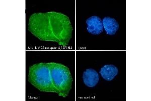 (ABIN185678) Immunofluorescence analysis of paraformaldehyde fixed MCF7 cells, permeabilized with 0.
