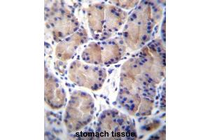 Immunohistochemistry (IHC) image for anti-Carboxylesterase 4A (CES4A) antibody (ABIN2997050)