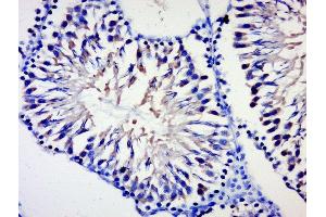 Paraformaldehyde-fixed, paraffin embedded rat testis, Antigen retrieval by boiling in sodium citrate buffer (pH6) for 15min, Block endogenous peroxidase by 3% hydrogen peroxide for 30 minutes, Blocking buffer (normal goat serum) at 37°C for 20min, Antibody incubation with 	BPTF/FALZ Polyclonal Antibody, Unconjugated  at 1:500 overnight at 4°C, followed by a conjugated secondary and DAB staining.