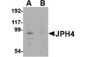 Western Blotting (WB) image for anti-Junctophilin 4 (JPH4) (Middle Region) antibody (ABIN1030971) (Junctophilin 4 anticorps  (Middle Region))