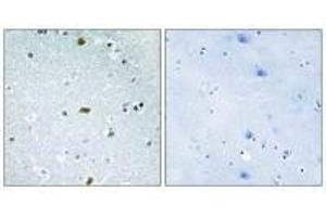 Immunohistochemistry analysis of paraffin-embedded human brain tissue, using ZFHX3 antibody. (ZFHX3 anticorps)
