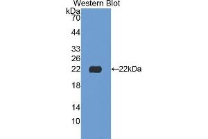 Western Blotting (WB) image for anti-Sialidase 1 (Lysosomal Sialidase) (NEU1) (AA 141-286) antibody (ABIN1174834) (NEU1 anticorps  (AA 141-286))