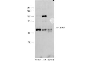 SYT3 antibody - N-terminal region  validated by WB using mouse, rat, and human brain lysates at 1ug/ml. (Synaptotagmin 3 anticorps  (N-Term))