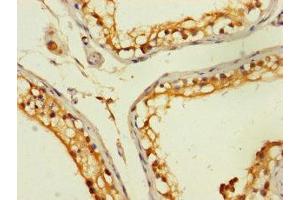 Immunohistochemistry of paraffin-embedded human testis tissue using ABIN7176385 at dilution of 1:100