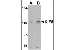 Image no. 1 for anti-Kinesin Family Member 5A (KIF5A) (Center) antibody (ABIN372915) (KIF5A anticorps  (Center))