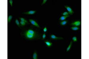 Immunofluorescence staining of Hela cells with ABIN7155077 at 1:133, counter-stained with DAPI. (HPS6 anticorps  (AA 221-319))