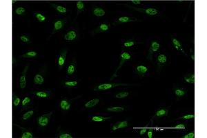 Immunofluorescence of monoclonal antibody to CDR2 on HeLa cell. (CDR2 anticorps  (AA 1-454))