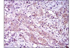 Immunohistochemistry (IHC) image for anti-Mitogen-Activated Protein Kinase 14 (MAPK14) (AA 299-360) antibody (ABIN1845584)