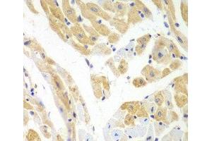 Immunohistochemistry of paraffin-embedded Mouse heart using PCBP2 Polyclonal Antibody at dilution of 1:100 (40x lens). (PCBP2 anticorps)