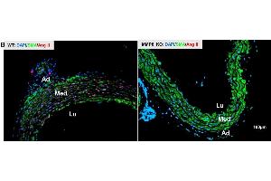 Immunofluorescent staining analysis of the Ang II expressions in thoracic aorta.