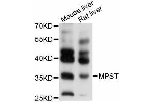 Western blot analysis of extracts of various cell lines, using MPST antibody (ABIN4904412) at 1:1000 dilution.