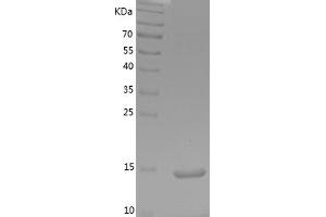 Western Blotting (WB) image for Interferon gamma (IFNG) (AA 23-156) (Active) protein (His tag) (ABIN7123490)