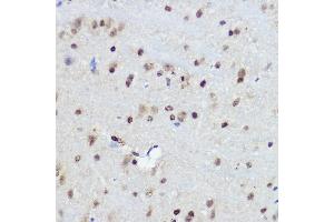 Immunohistochemistry of paraffin-embedded Mouse brain using FANCC antibody (ABIN3022593, ABIN3022594, ABIN3022595 and ABIN6218931) at dilution of 1:100 (40x lens). (FANCC anticorps  (AA 319-558))