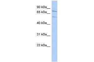 WB Suggested Anti-ZNF395 Antibody Titration: 0. (ZNF395 anticorps  (Middle Region))