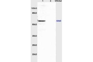 Lane 1: mouse spleen lysates Lane 2: mouse brain lysates probed with Anti APBA3/Mint3/X11 gamma Polyclonal Antibody, Unconjugated (ABIN1385696) at 1:200 in 4 °C.