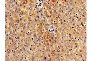 Immunohistochemistry of paraffin-embedded human liver tissue using ABIN7170645 at dilution of 1:100