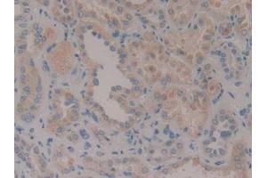 DAB staining on IHC-P; Samples: Human Kidney Tissue (CENPF anticorps  (AA 436-637))