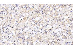 Detection of SIRT3 in Human Stomach Tissue using Monoclonal Antibody to Sirtuin 3 (SIRT3)