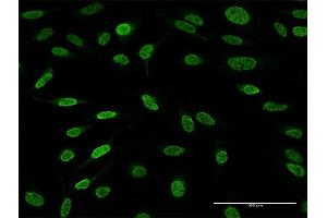 Immunofluorescence of purified MaxPab antibody to AFF4 on HeLa cell.