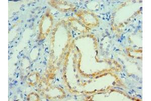 Immunohistochemistry of paraffin-embedded human kidney tissue using ABIN7165065 at dilution of 1:100 (PRMT1 anticorps  (AA 20-353))
