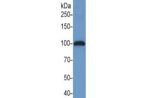 Rabbit Detection antibody from the kit in WB with Positive Control: Human placenta lysate.