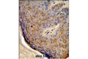 Formalin-fixed and paraffin-embedded human skin tissue reacted with TCHP Antibody (Center), which was peroxidase-conjugated to the secondary antibody, followed by DAB staining.