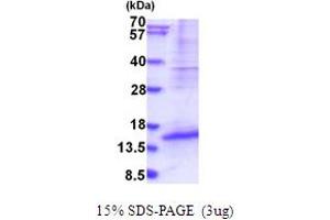 SDS-PAGE (SDS) image for Developmental Pluripotency Associated 5 (DPPA5) (AA 1-116) protein (His tag) (ABIN5853995)
