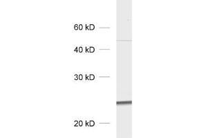 dilution: 1 : 1000, sample: total cell lysate of GFP transfected fibroblasts (GFP anticorps)