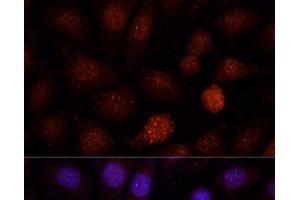 Immunofluorescence analysis of L-929 cells using PCGF1 Polyclonal Antibody at dilution of 1:100. (PCGF1 anticorps)