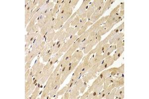 Immunohistochemistry of paraffin-embedded rat heart using SNRPA Antibody. (SNRPA1 anticorps  (AA 1-282))
