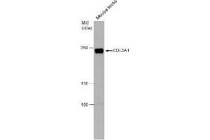 WB Image COL3A1 antibody [C2C3], C-term detects COL3A1 protein by western blot analysis. (COL3A1 anticorps  (C-Term))