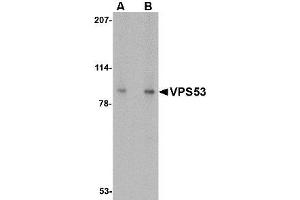 Image no. 1 for anti-Vacuolar Protein Sorting 53 Homolog (VPS53) (C-Term) antibody (ABIN1492163) (VPS53 anticorps  (C-Term))