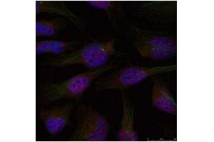 Image no. 3 for anti-Nuclear Factor-kB p65 (NFkBP65) (Ser276) antibody (ABIN197110) (NF-kB p65 anticorps  (Ser276))