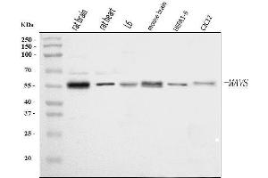 Western blot analysis of Mavs using anti-Mavs antibody (ABIN7599544).
