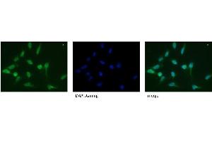 CD107a / LAMP1 Antibody Cat. (LAMP1 anticorps)