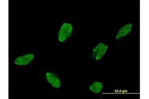 Immunofluorescence of monoclonal antibody to ASCL1 on HeLa cell. (ASCL1 anticorps  (AA 137-236))