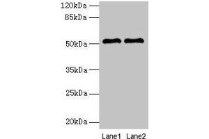 Western blot All lanes: SLC30A6 antibody at 6 μg/mL Lane 1: A549 whole cell lysate Lane 2: U251 whole cell lysate Secondary Goat polyclonal to rabbit IgG at 1/10000 dilution Predicted band size: 52, 56, 48, 49 kDa Observed band size: 52 kDa (SLC3A6 (AA 246-461) anticorps)