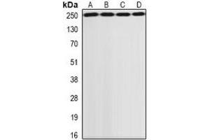 Western blot analysis of GCN2 expression in SKOV3 (A), HepG2 (B), MCF7 (C), rat lung (D) whole cell lysates. (GCN2 anticorps)