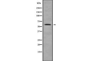 Western blot analysis of MAGE2 using COLO205 whole cell lysates (MAGEE2 anticorps  (Internal Region))