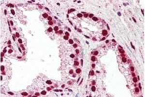 ABIN184730 (5µg/ml) staining of paraffin embedded Human Prostate.