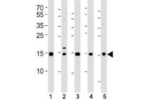 Western blot analysis of lysate from (1) 293T, (2) HeLa, (3) HL-60, (4) Jurkat cell lines and (5) rat liver tissue using SUMO2/3 antibody at 1:1000. (SUMO2/3 anticorps  (AA 49-81))