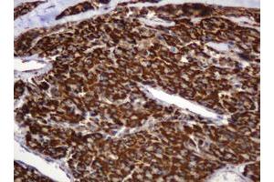 Image no. 7 for anti-B and T Lymphocyte Associated (BTLA) antibody (ABIN1496983) (BTLA anticorps)