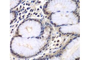 Immunohistochemistry of paraffin-embedded Human colon using PSMB2 Polyclonal Antibody at dilution of 1:100 (40x lens). (PSMB2 anticorps)