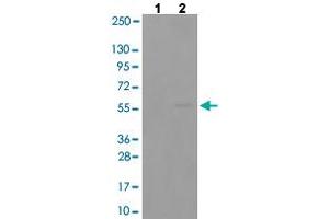 Western blot analysis of Lane 1: antigen-specific peptide treated COLO205 cells, Lane 2: COLO205 cells with SYT1 (phospho T202) polyclonal antibody  at 1:500-1:1000 dilution. (SYT1 anticorps  (pThr202))