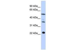 Image no. 1 for anti-Centromere Protein M (CENPM) (C-Term) antibody (ABIN6740964) (CENPM anticorps  (C-Term))