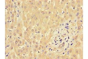 Immunohistochemistry of paraffin-embedded human liver tissue using ABIN7165997 at dilution of 1:100 (BBS9 anticorps  (AA 8-185))