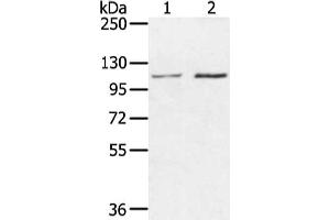 Gel: 6 % SDS-PAGE, Lysate: 40 μg, Lane 1-2: Hepg2 and hela cell, Primary antibody: ABIN7130215(MED16 Antibody) at dilution 1/400 dilution, Secondary antibody: Goat anti rabbit IgG at 1/8000 dilution, Exposure time: 20 seconds (MED16 anticorps)