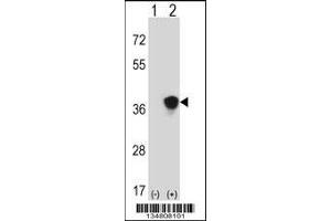 Western blot analysis of Map2k3 using rabbit polyclonal Mouse Map2k3 Antibody using 293 cell lysates (2 ug/lane) either nontransfected (Lane 1) or transiently transfected (Lane 2) with the Map2k3 gene.